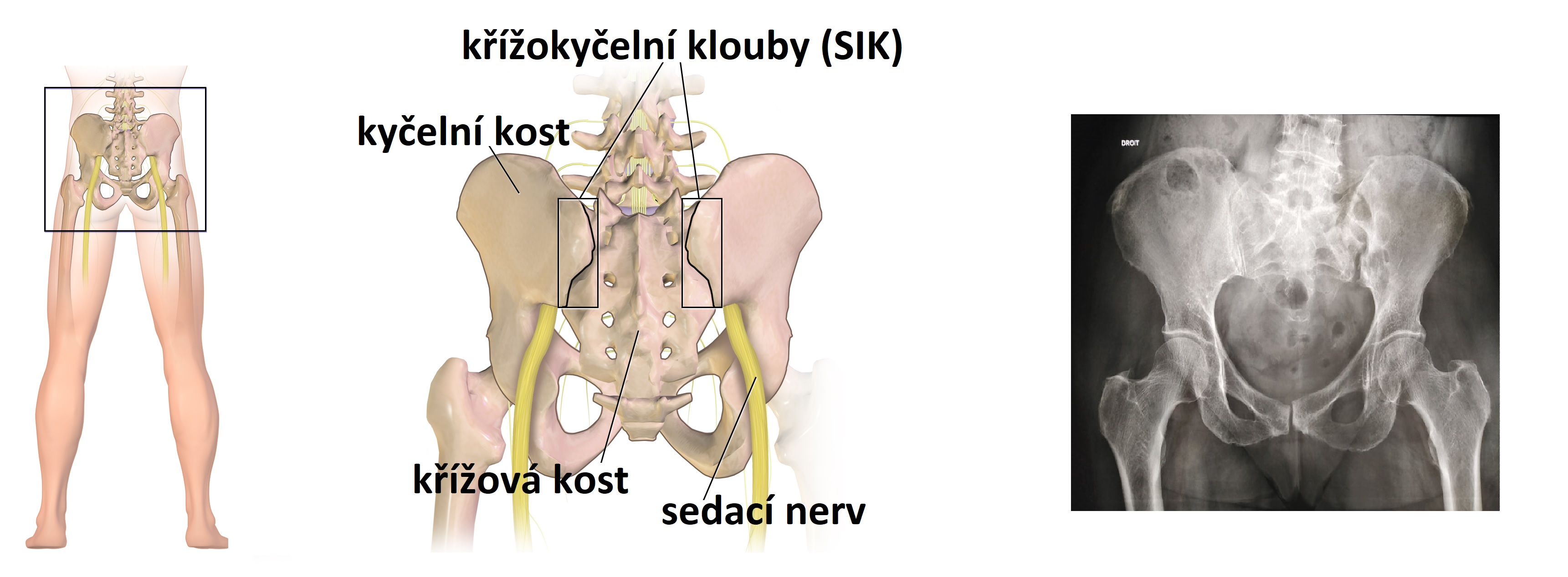 SI klouby